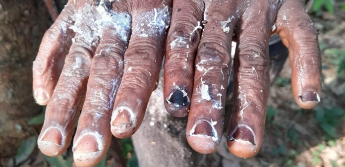 photo-mains-1-Copie-1-scaled-1468x710